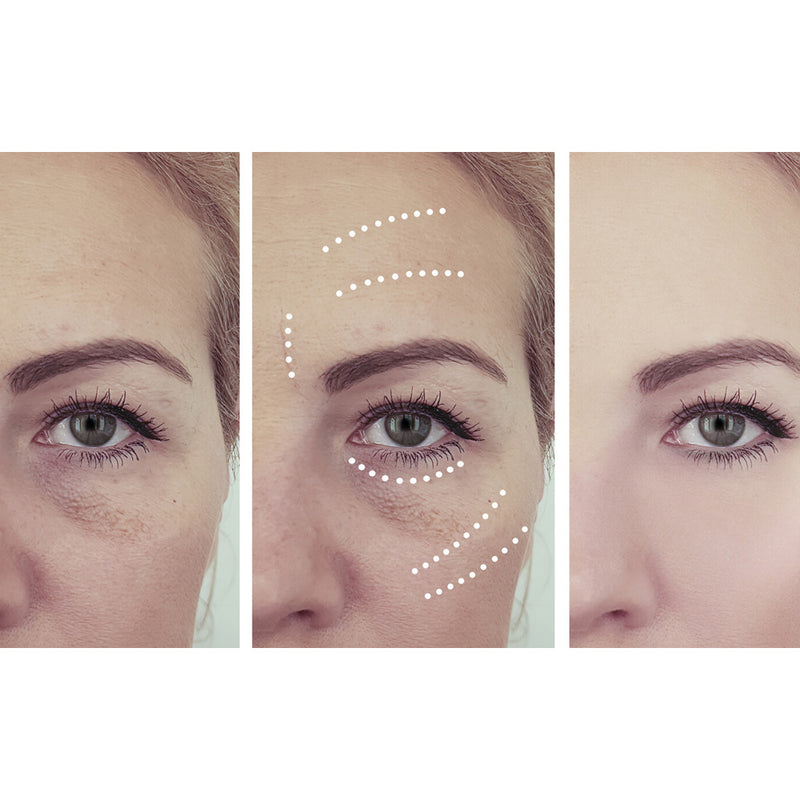Perfect Miracle Eye Anti-ageing Hyaluronic Acid Serum Before and After Images