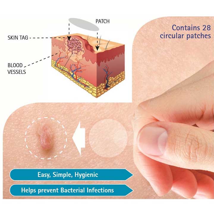 Skin Tag Patch Benefits on the Skin