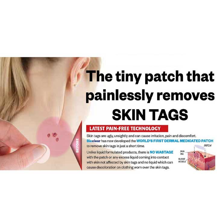 Skin Tag Patch Health Benefits