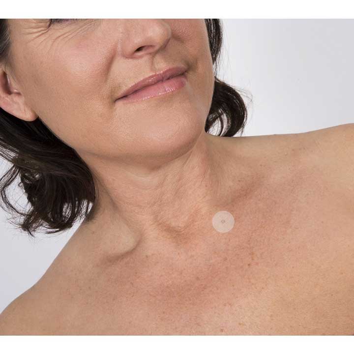 Skin Tag Patch on a Female décolletage